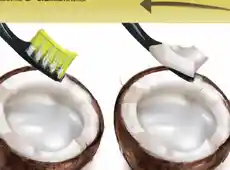 10 Most Recommended Coconut Oil For Teeth Whitening