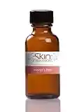 Skin Obsession JESSNER'S at HOME Chemical Peel (1oz bottle) Helps Treat Acne Scars, Pimples, fine lines