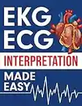 EKG | ECG Interpretation Made Easy: An Illustrated Study Guide For Students To Easily Learn How To Read & Interpret ECG Strips