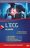 L'ECG en poche