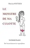 Le monstre de ma culotte: TEMOIGNAGE : De l'accouchement à la vaginoplastie