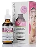 Advanced Clinicals Rosehip Oil Facial Skin Care Serum Moisturizer Face Oil W/Vitamin C & Vitamin E For Reducing Appearance Of Sun Damage Skin, Age Spots, & Wrinkles, 1.8 Fl Oz (Pack of 1)