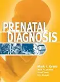 Prenatal Diagnosis (English Edition)
