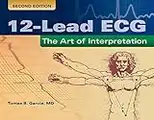 12-Lead Ecg: The Art Of Interpretation