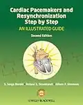 Cardiac Pacemakers and Resynchronization Step by Step: An Illustrated Guide (English Edition)