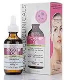 Advanced Clinicals Rosehip Oil Facial Skin Care Serum Moisturizer Face Oil W/Vitamin C & Vitamin E For Reducing Appearance Of Sun Damage Skin, Age Spots, & Wrinkles, 1.8 Fl Oz (Pack of 1)