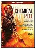 Chemical Peel [Import]