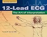 12-Lead Ecg: The Art Of Interpretation